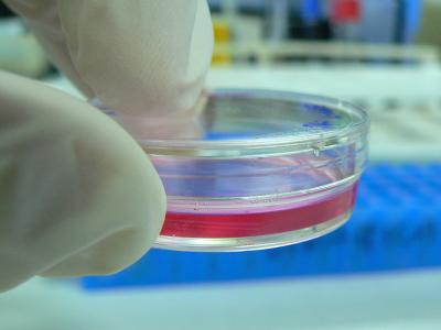 Biotech startup stock options